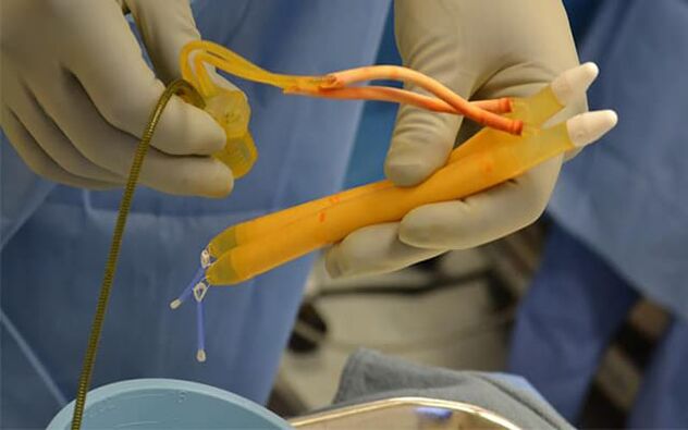 Implantes no pene